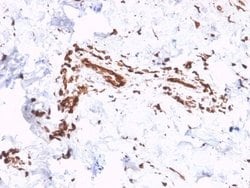 Collagen VII Antibody (LH7.2) - Azide and BSA Free, Novus Biologicals 100 &mu;g | Buy Online | Novus Biologicals | Fisher Scientific